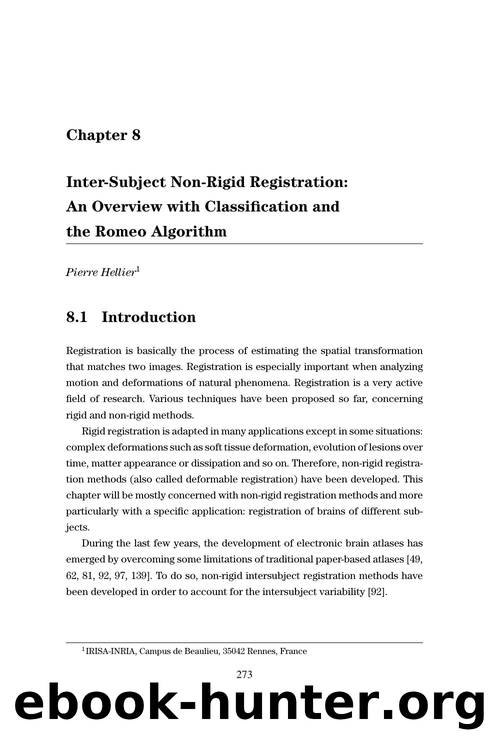 08 inter subject non rigid registration ad overview with classification and the romeo algorithm by Unknown