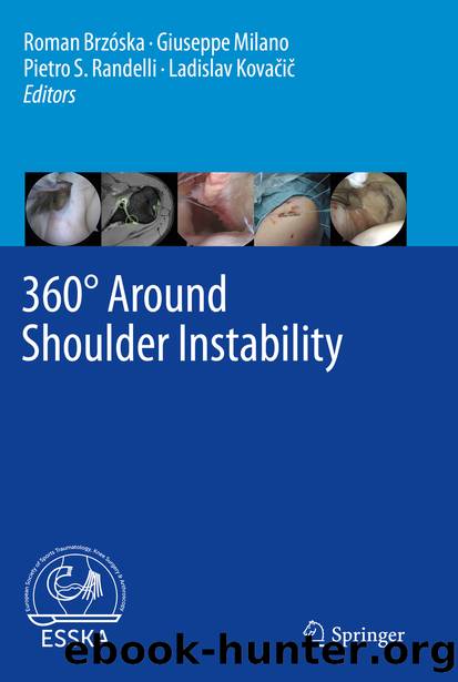 360° Around Shoulder Instability by Unknown