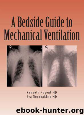A Bedside Guide To Mechanical Ventilation by unknow