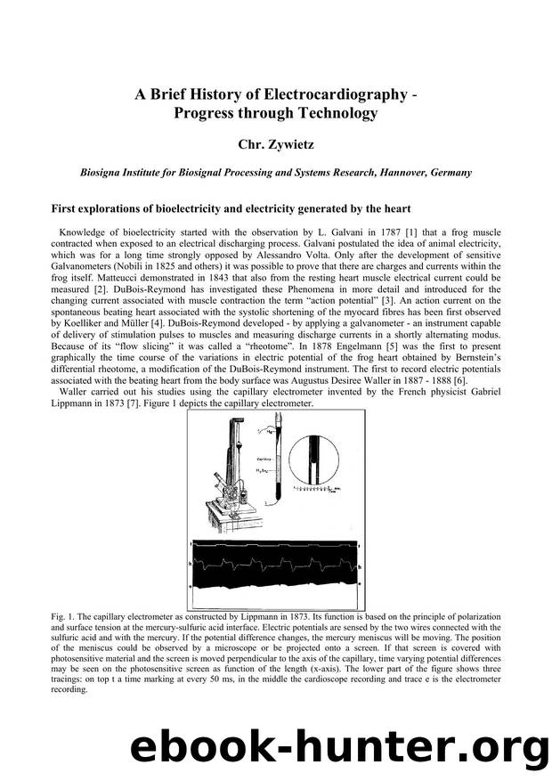 A Brief History of Electrocardiography by Chr. Zywietz