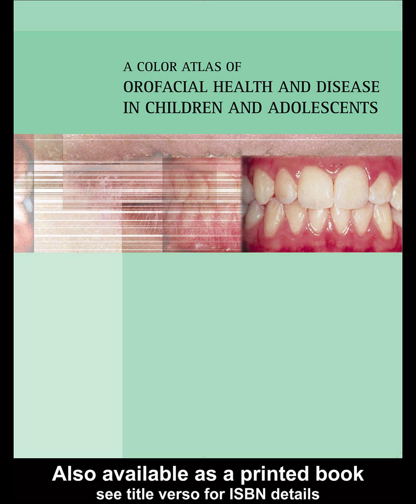 A Color Atlas of Orofacial Health and Disease in Children and Adolescents Diagnosis and management by Crispian Scully Richard Welbury Catherine Flaitz & Oslei Paes de Almeida