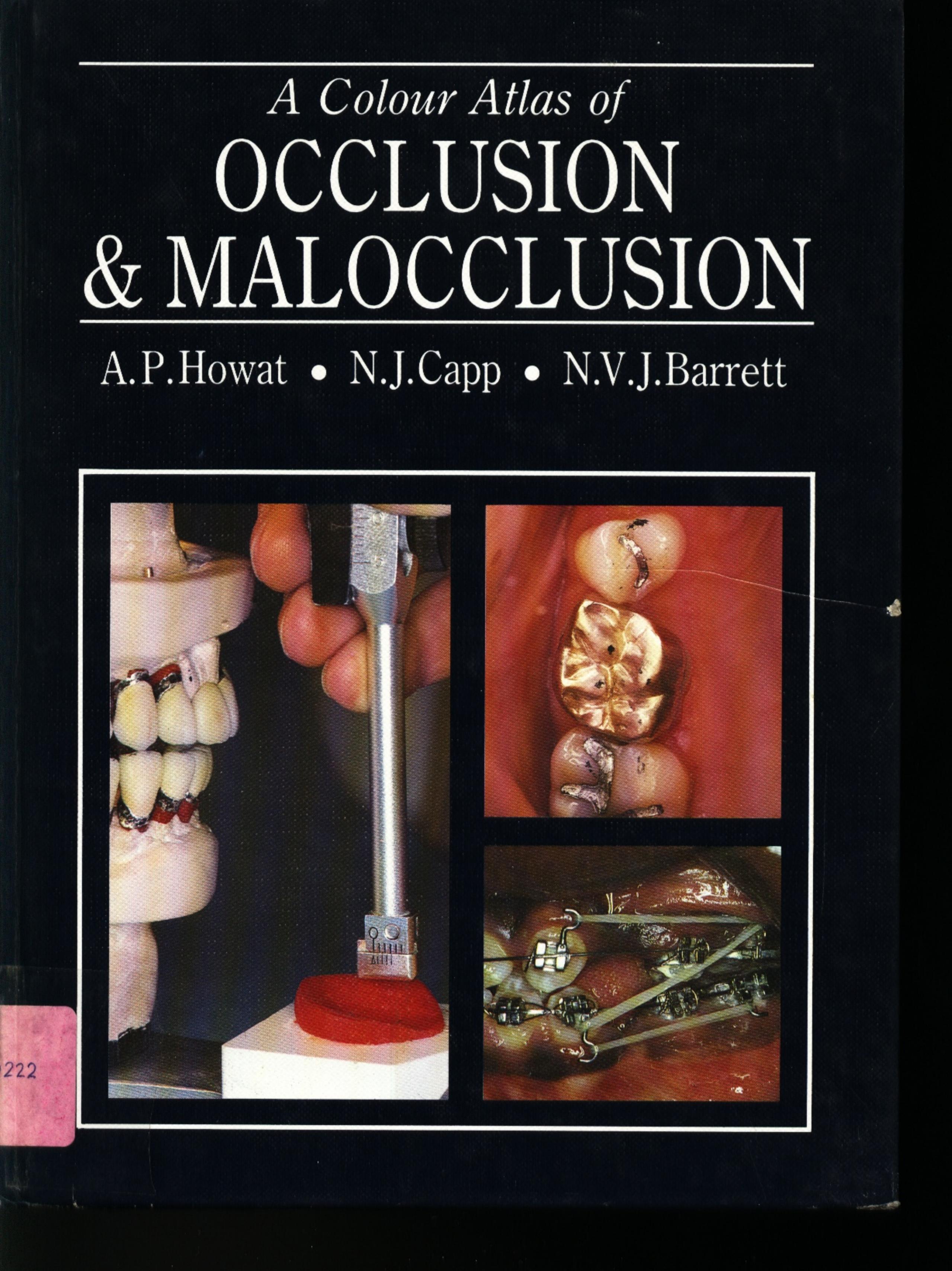 A Colour Atlas of Occlusion and Malocclusion by Alison P. Howat etc. Nicholas J. Capp Nicholas V.J. Barrett