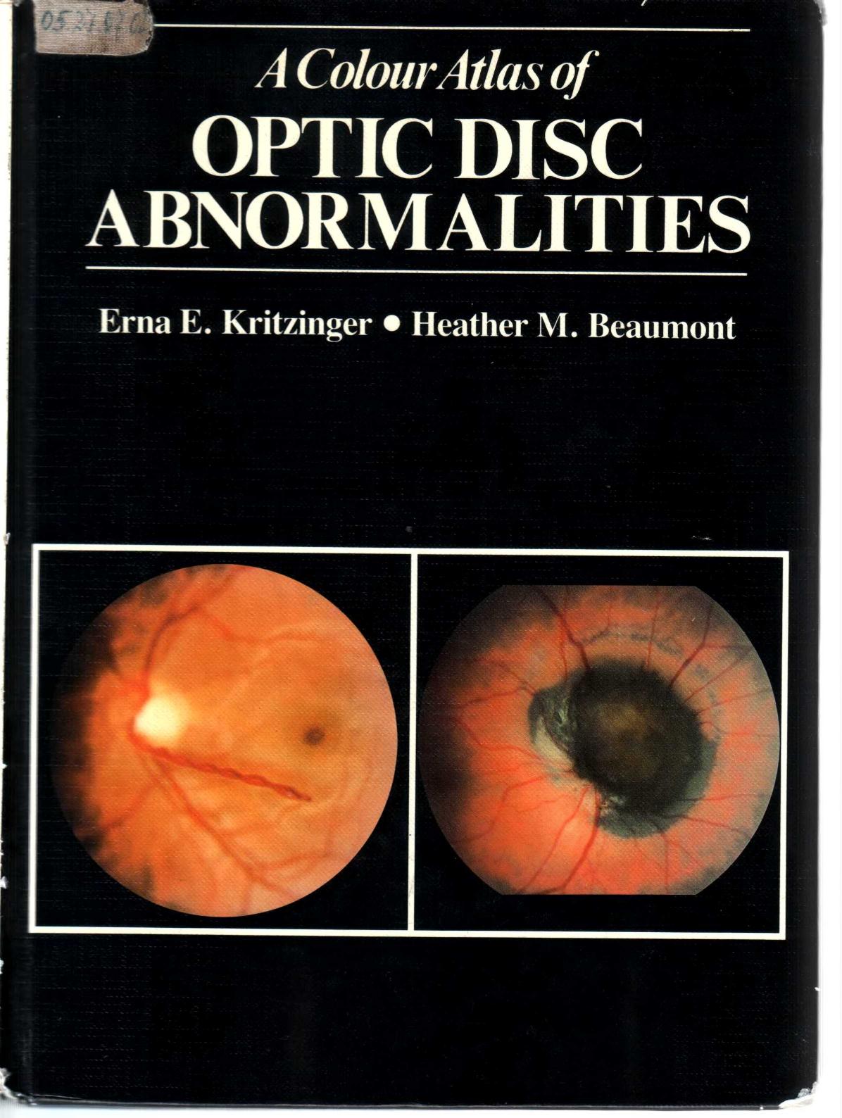 A Colour Atlas of Optic Disc Abnormalities by Erna E. Kritzinger Heather M. Beaumont