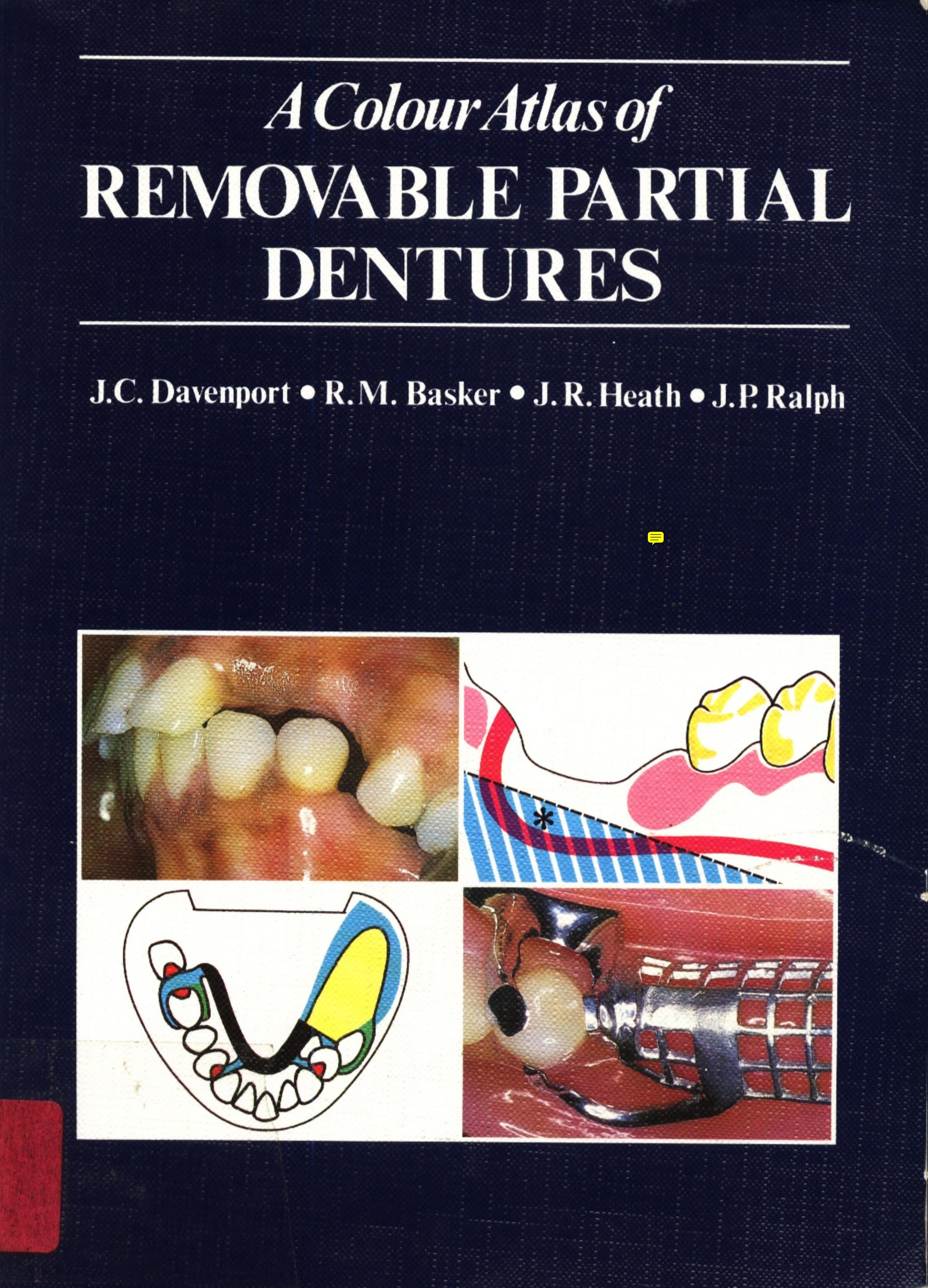 A Colour Atlas of Removable Partial Dentures by J.C. Davenport R.M. Basker J.R. Heath J.P. Ralph
