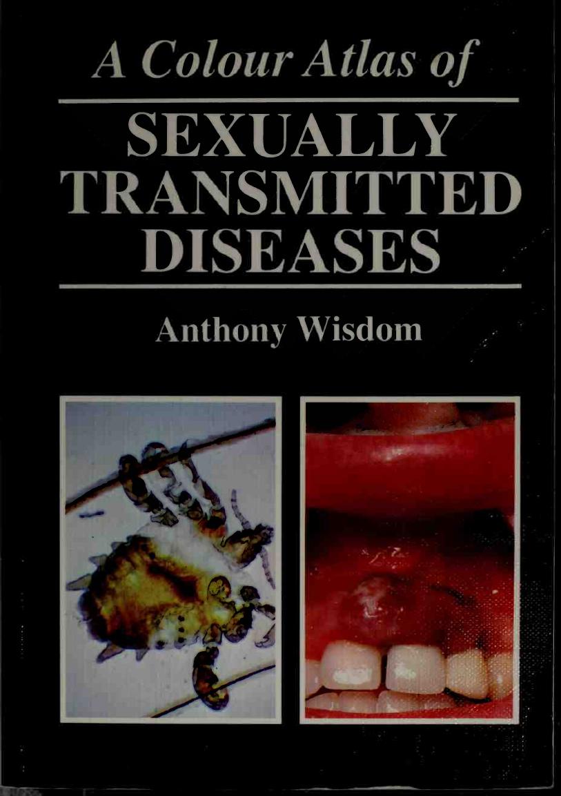 A Colour Atlas of Sexually Transmitted Diseases by Anthony Wisdom
