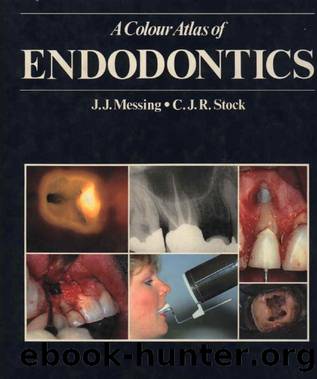 A Colour atlas of Endodontics by Unknown