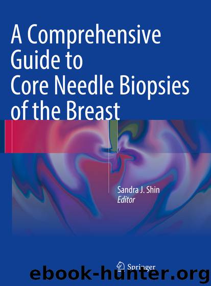 A Comprehensive Guide to Core Needle Biopsies of the Breast by Sandra J. Shin