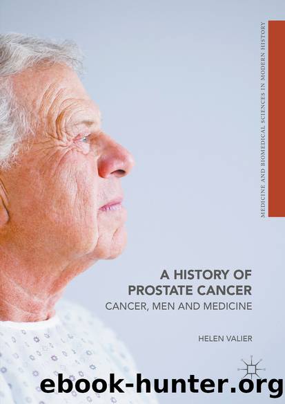 A History of Prostate Cancer by Helen Valier
