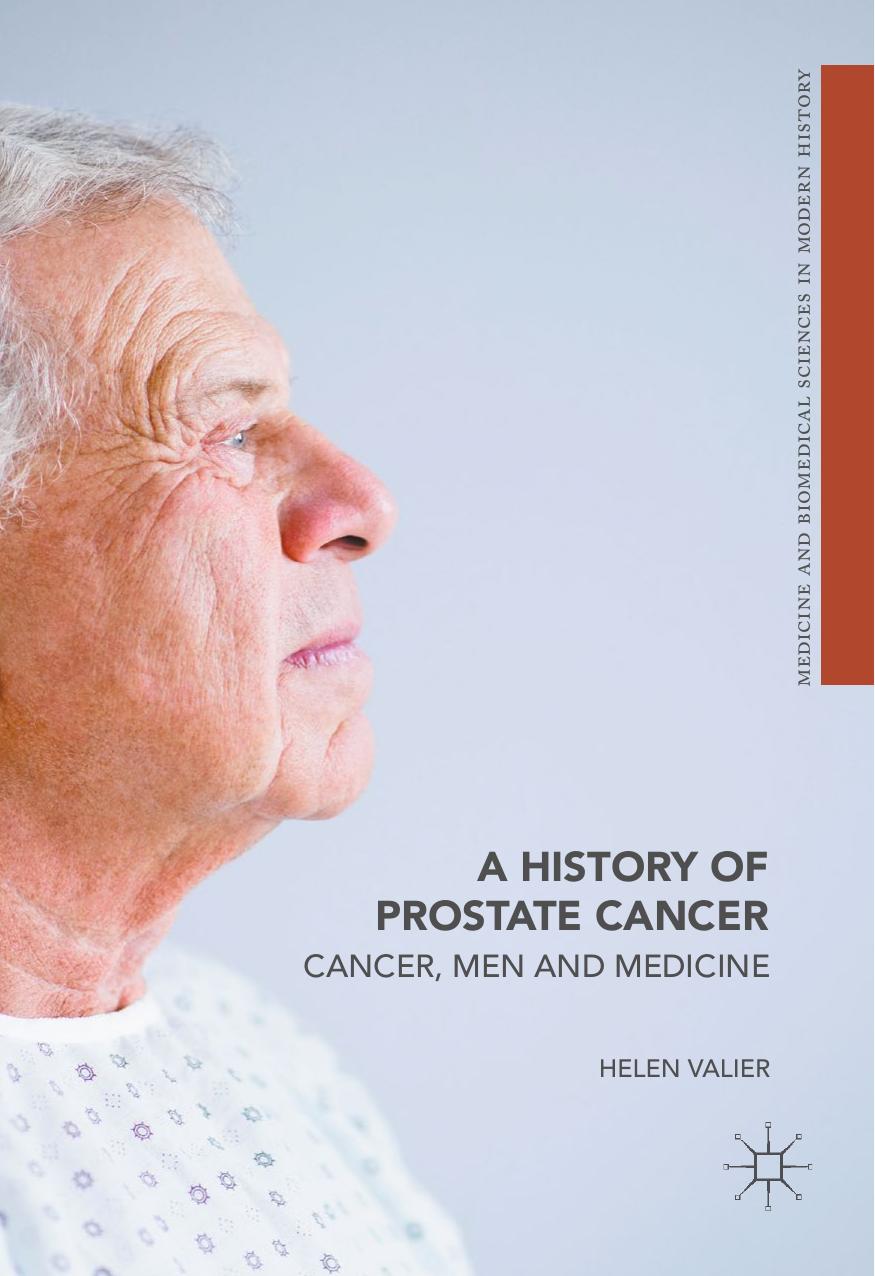 A History of Prostate Cancer: Cancer, Men and Medicine by Helen Valier (auth.)
