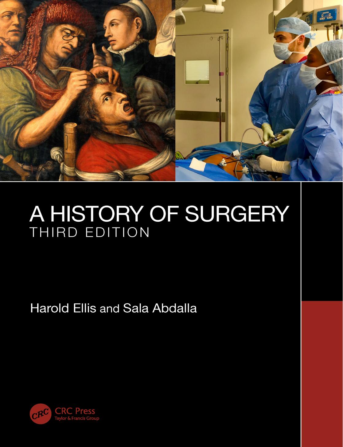 A History of Surgery by Abdalla Sala; Ellis Harold