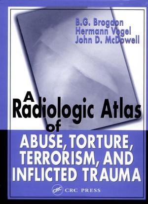 A Radiologic Atlas of Abuse, Torture, Terrorism, and Inflicted Trauma by B. G. Brogdon Hermann Vogel John D. McDowell