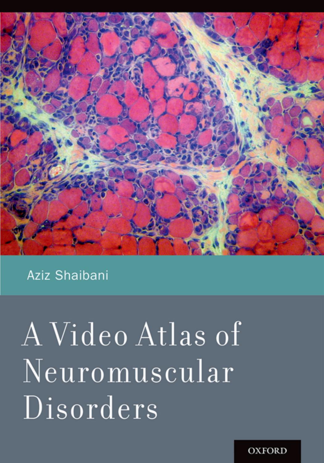 A Video Atlas of Neuromuscular Disorders by Aziz Shaibani
