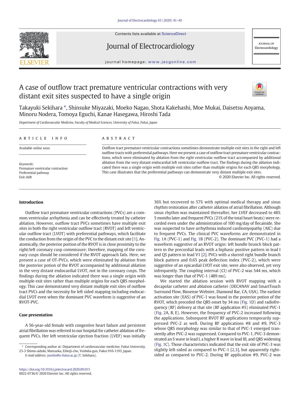 A case of outflow tract premature ventricular contractions with very distant exit sites suspected to have a single origin by unknow