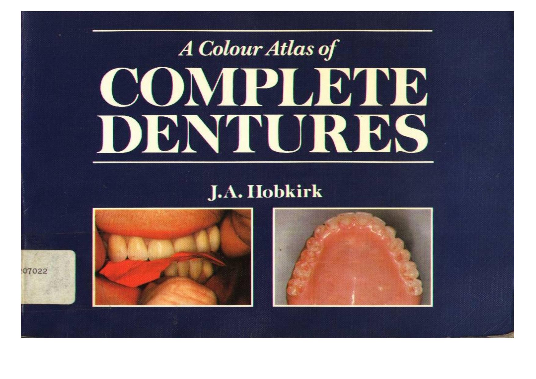A colour atlas of complete dentures by John A Hobkirk