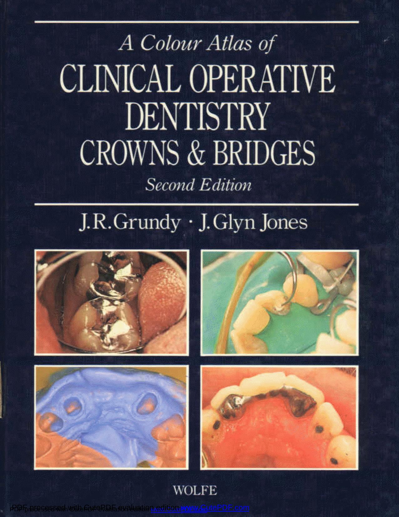 A coloure atlas of clinical operative dentistary crown and bridges by Unknown
