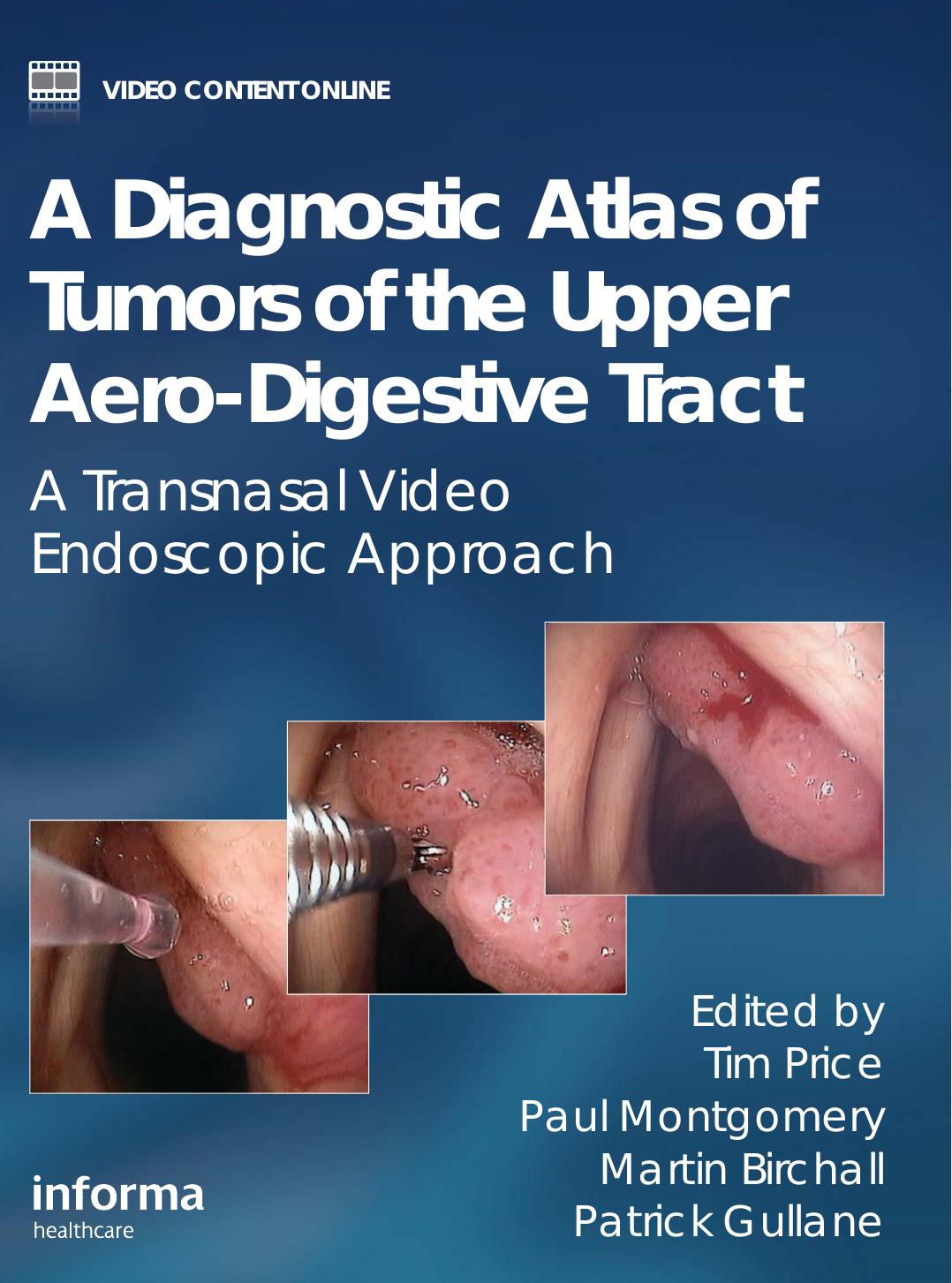 A diagnostic atlas of tumors of the upper aero-digestive tract: a transnasal video endoscopic approach by Tim Price