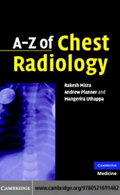 A-Z of Chest Radiology by Andrew Planner Mangerira Uthappa Rakesh Misra
