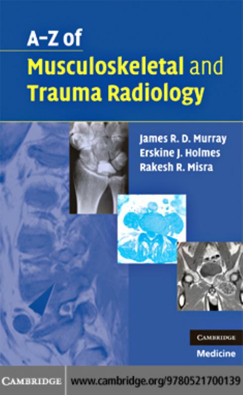 A-Z of Musculoskeletal and Trauma Radiology (Repost) by Unknow