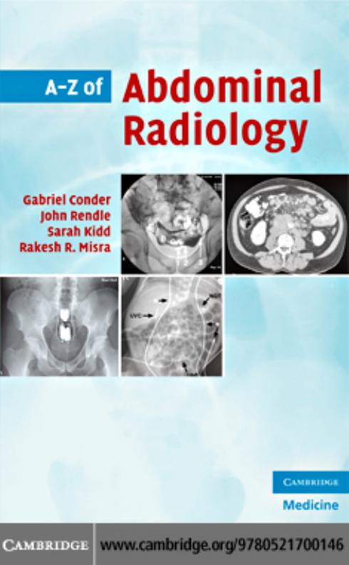 A-Z of abdominal radiology by Hartwell Conder John Rendle Sarah Kidd Rakesh R. Misra