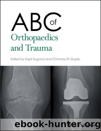 ABC of Orthopaedics and Trauma by Kapil Sugand & Chinmay M. Gupte