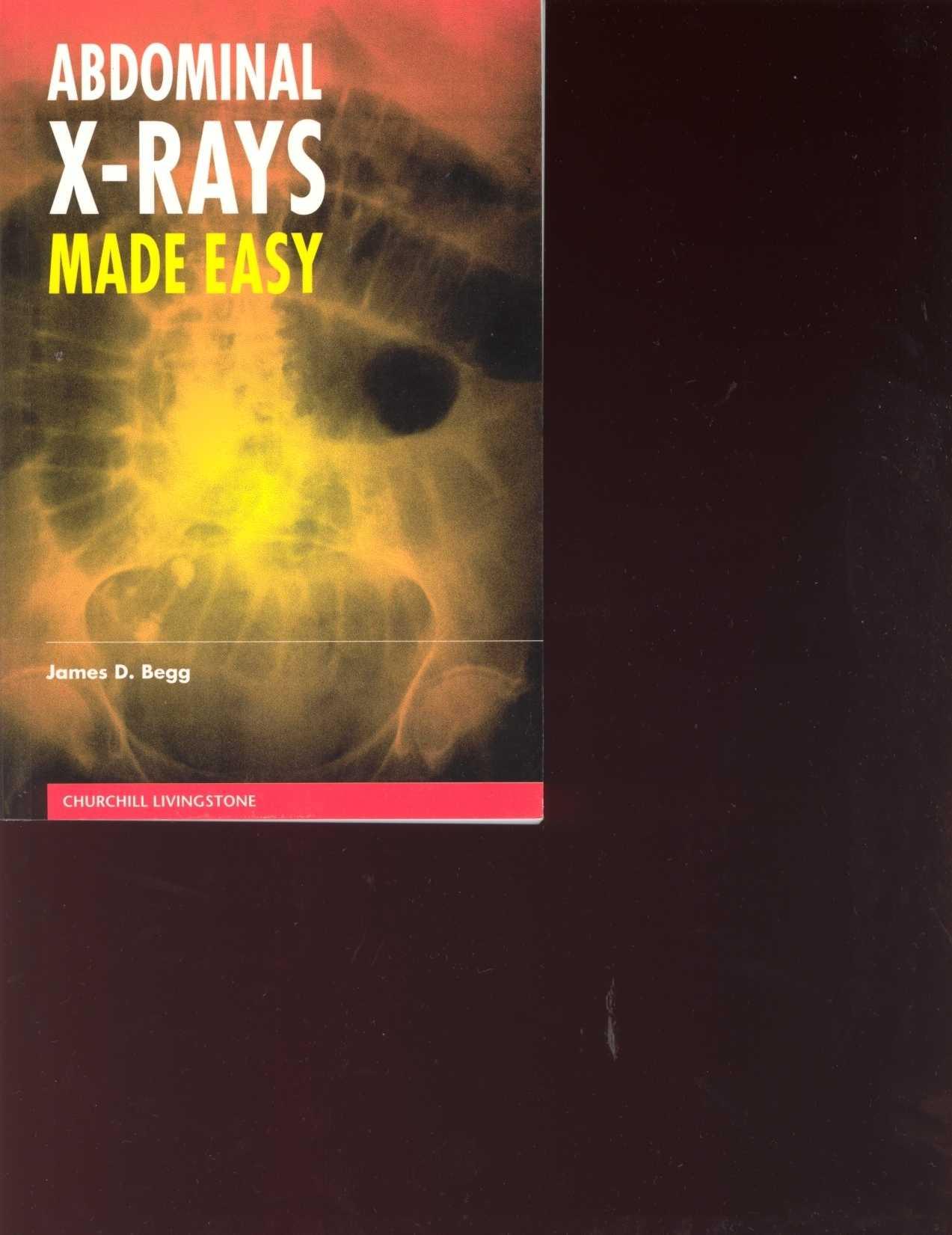 ABDOMINAL X-RAYS MADE EASY by Unknown