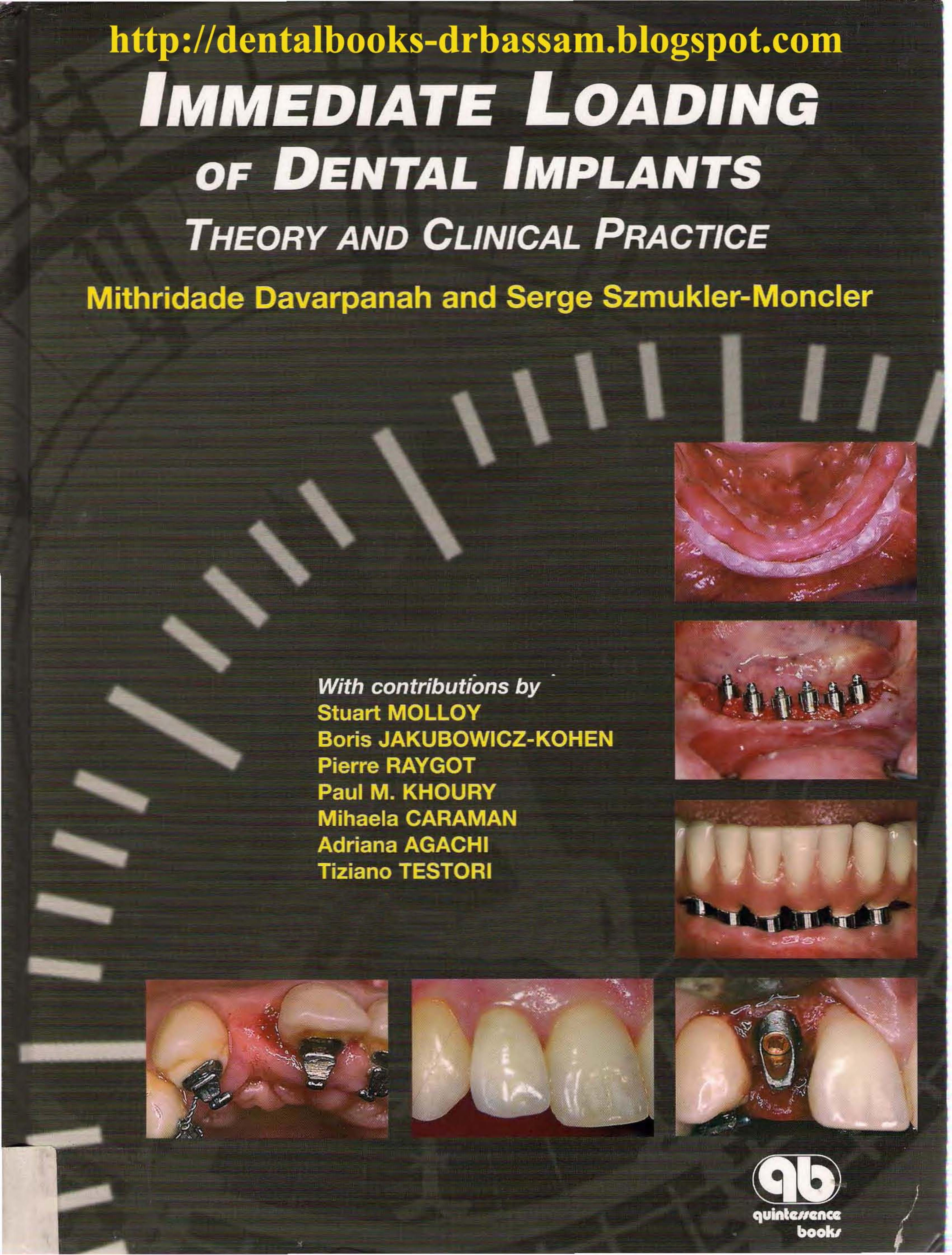 ACDSee PDF Image. by Quintessence Pub; 1 edition (January 30 2009)