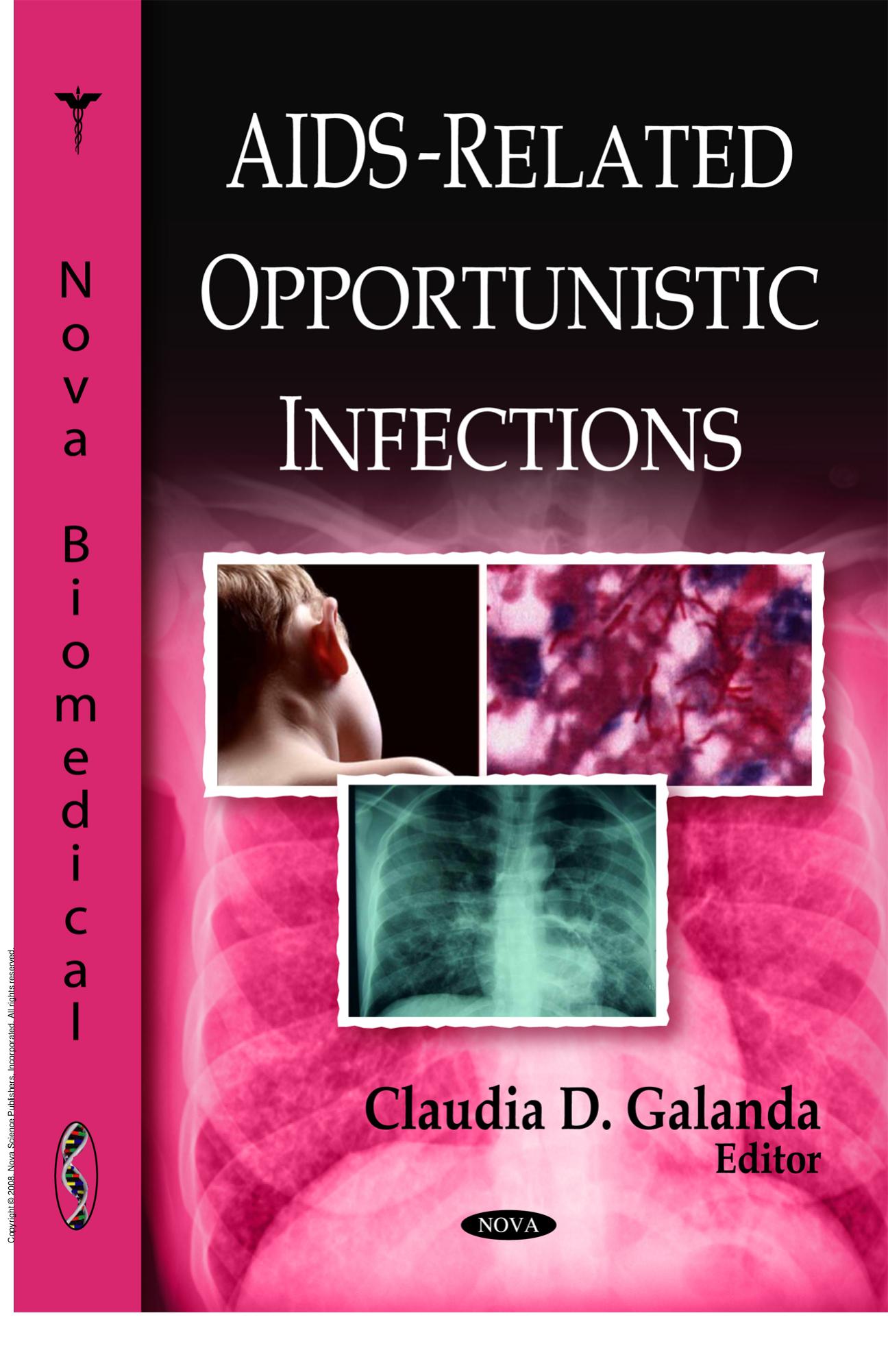 AIDS-Related Opportunistic Infections by Claudia D. Galanda