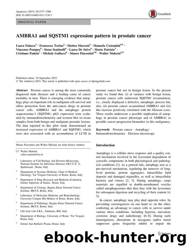 AMBRA1 and SQSTM1 expression pattern in prostate cancer by unknow