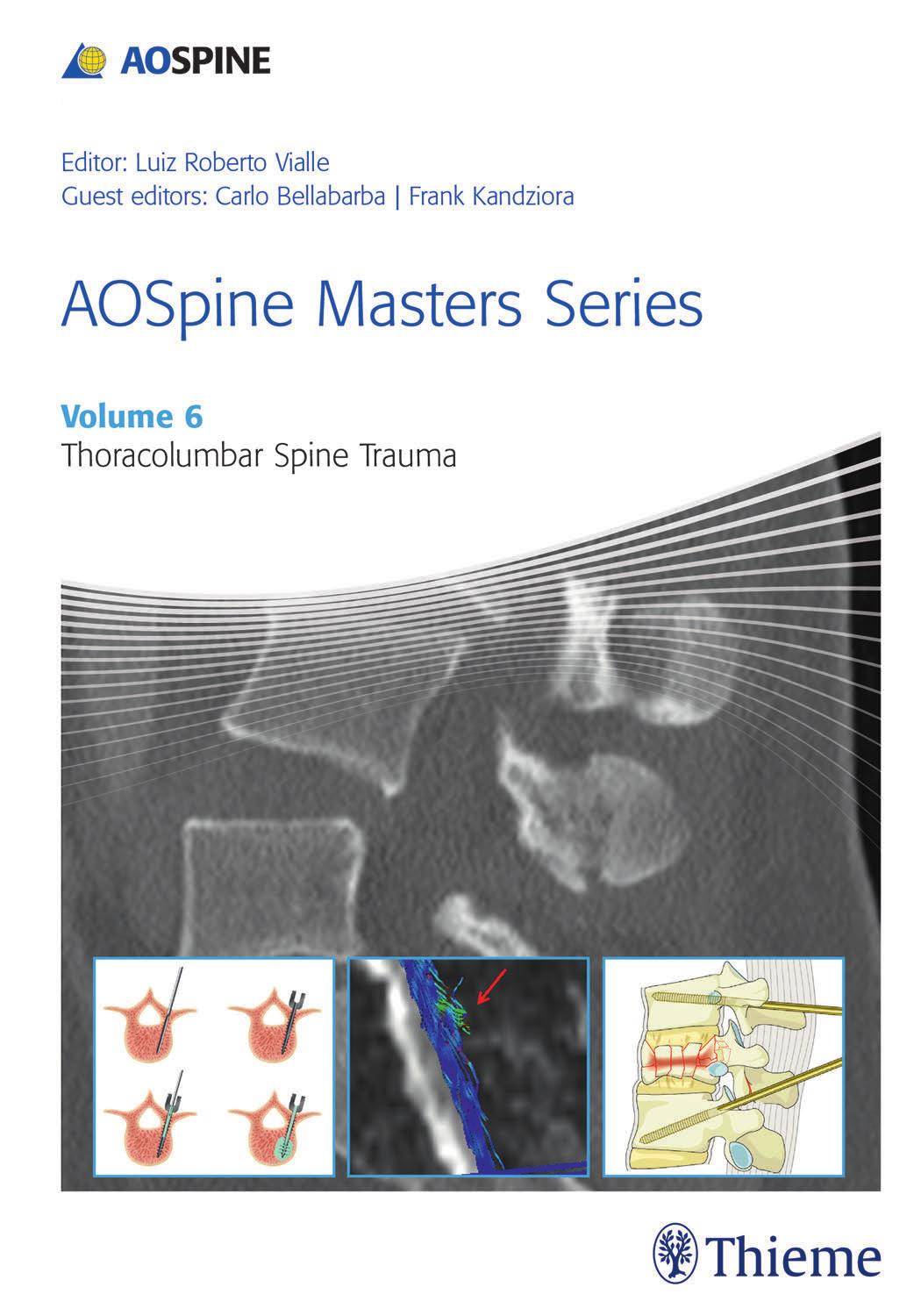 AOSpine Masters Series, Volume 6: Thoracolumbar Spine Trauma by Unknow