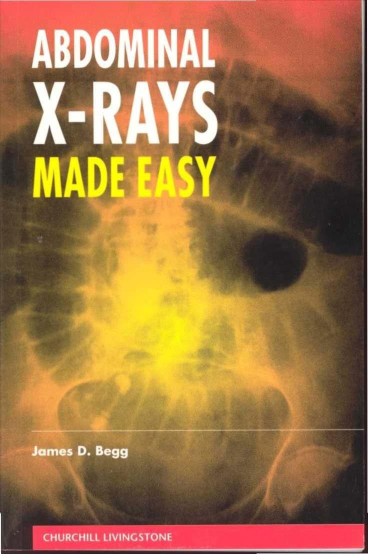 Abdominal X-Rays Made Easy 1st ed by James D. Begg