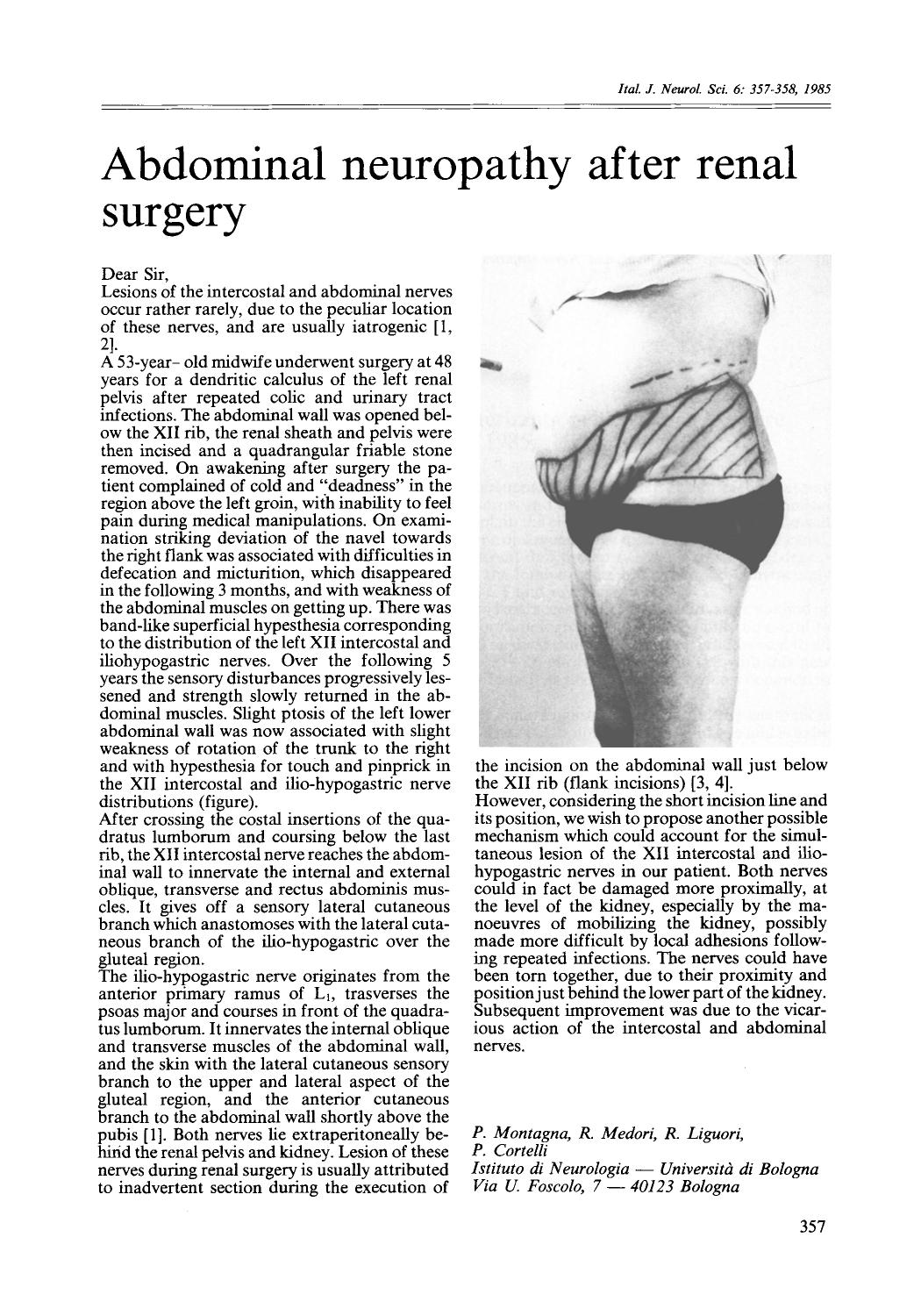 Abdominal neuropathy after renal surgery by Unknown