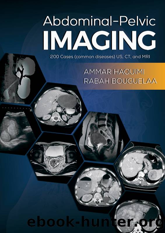 Abdominal-Pelvic Imaging by Ammar Haouimi & Rabah Bouguelaa