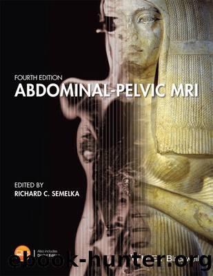 Abdominal-Pelvic MRI by Richard C. Semelka