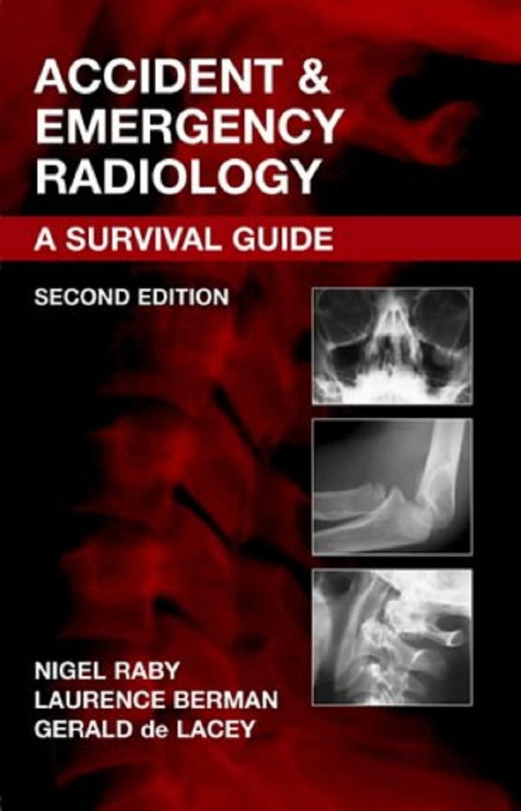Accident & emergency radiology : a survival guide by Berman Laurence; Raby Nigel; De Lacey Gerald