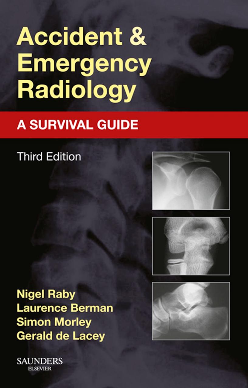 Accident and Emergency Radiology: A Survival Guide by Nigel Raby Laurence Berman Simon Morley Gerald de Lacey