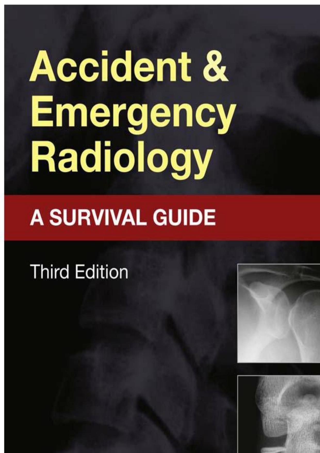 Accident and Emergency Radiology: A Survival Guide by Nigel Raby; Gerald De Lacey; Laurence Berman
