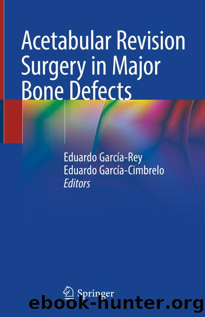 Acetabular Revision Surgery in Major Bone Defects by Unknown
