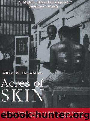Acres of Skin by Hornblum Allen M