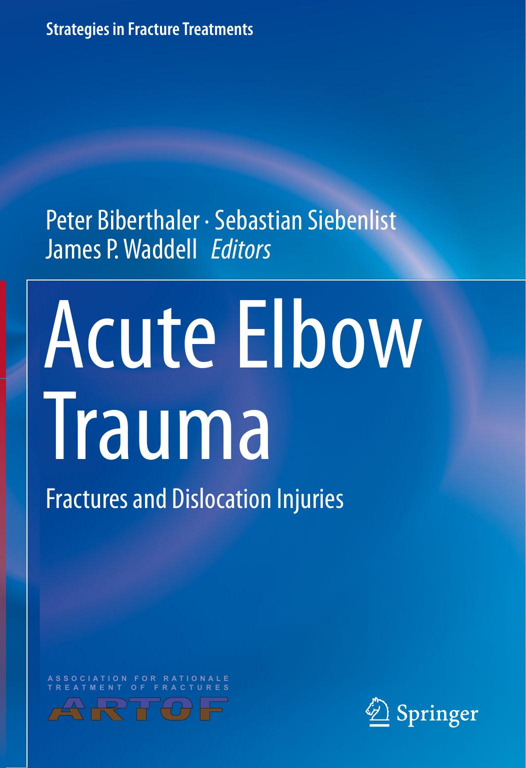 Acute Elbow Trauma: Fractures and Dislocation Injuries by Peter Biberthaler Sebastian Siebenlist James P. Waddell