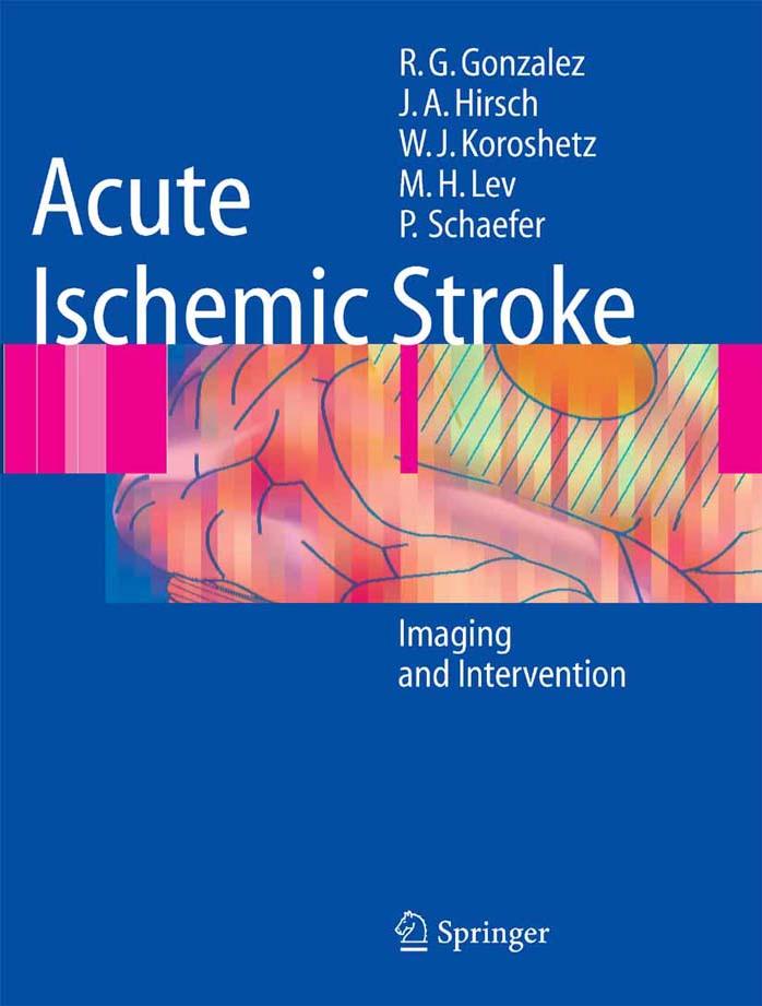 Acute Ischemic Stroke Imaging and Intervention by Hwang Nian Chih London Lucien Ooi