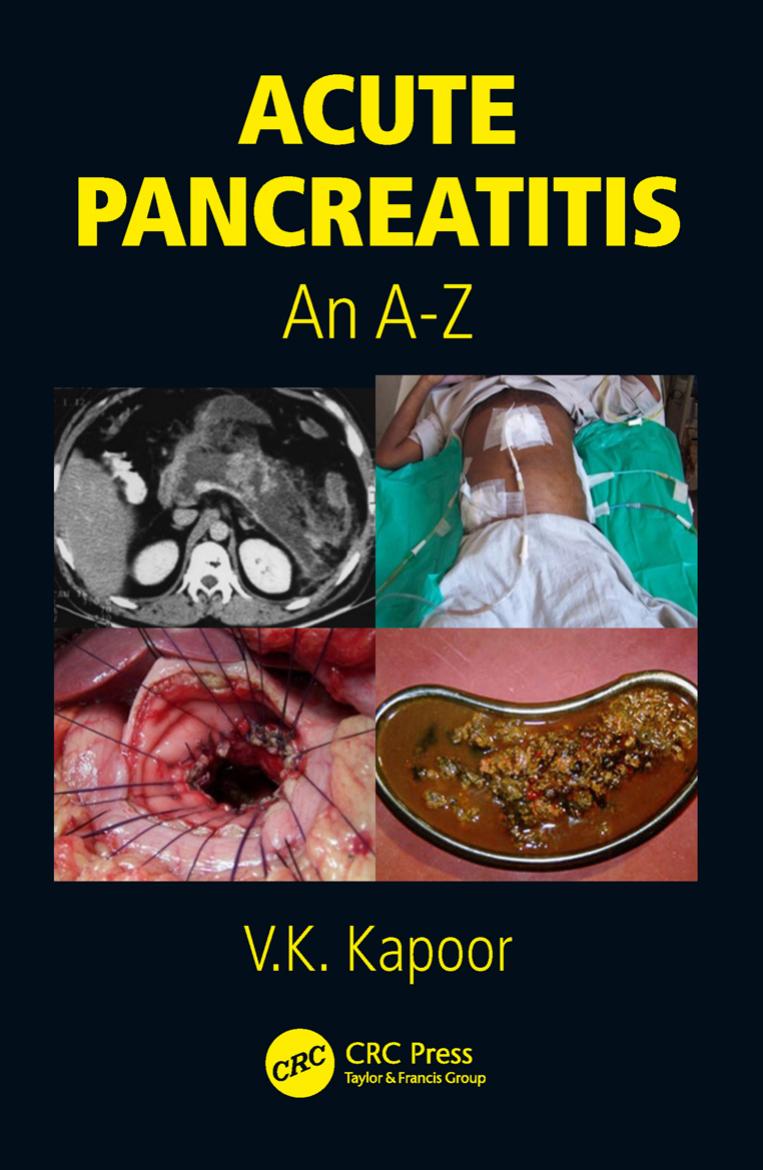 Acute Pancreatitis : An A-Z by Vinay Kumar Kapoor