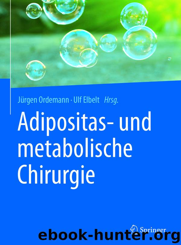 Adipositas- und metabolische Chirurgie by Jürgen Ordemann & Ulf Elbelt