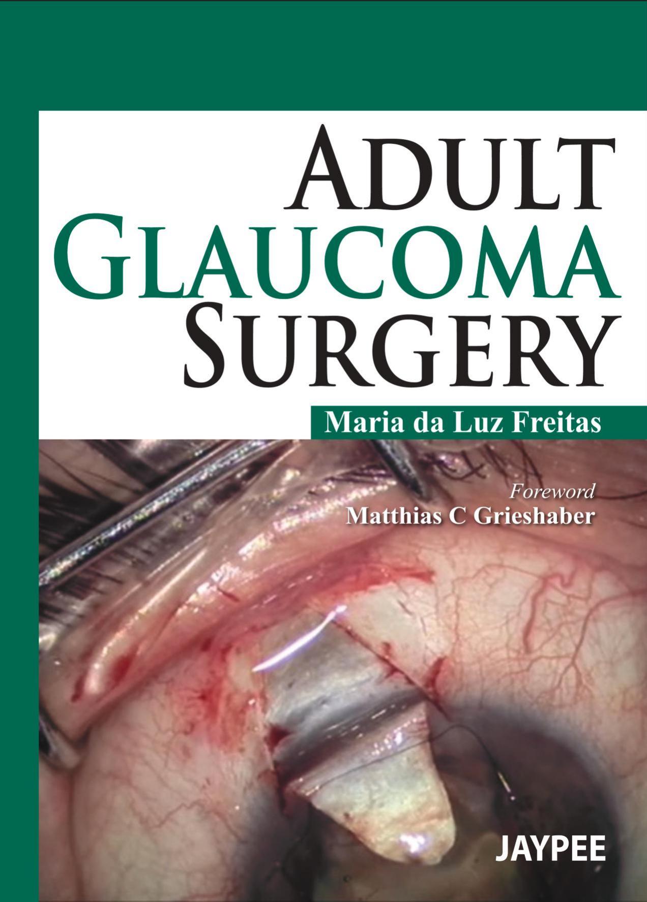 Adult Glaucoma Surgery by Freitas M
