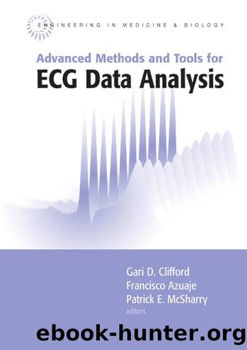 Advanced Methods and Tools for ECG Data Analysis by Gari D. Clifford Francisco Azuaje Patrick McSharry