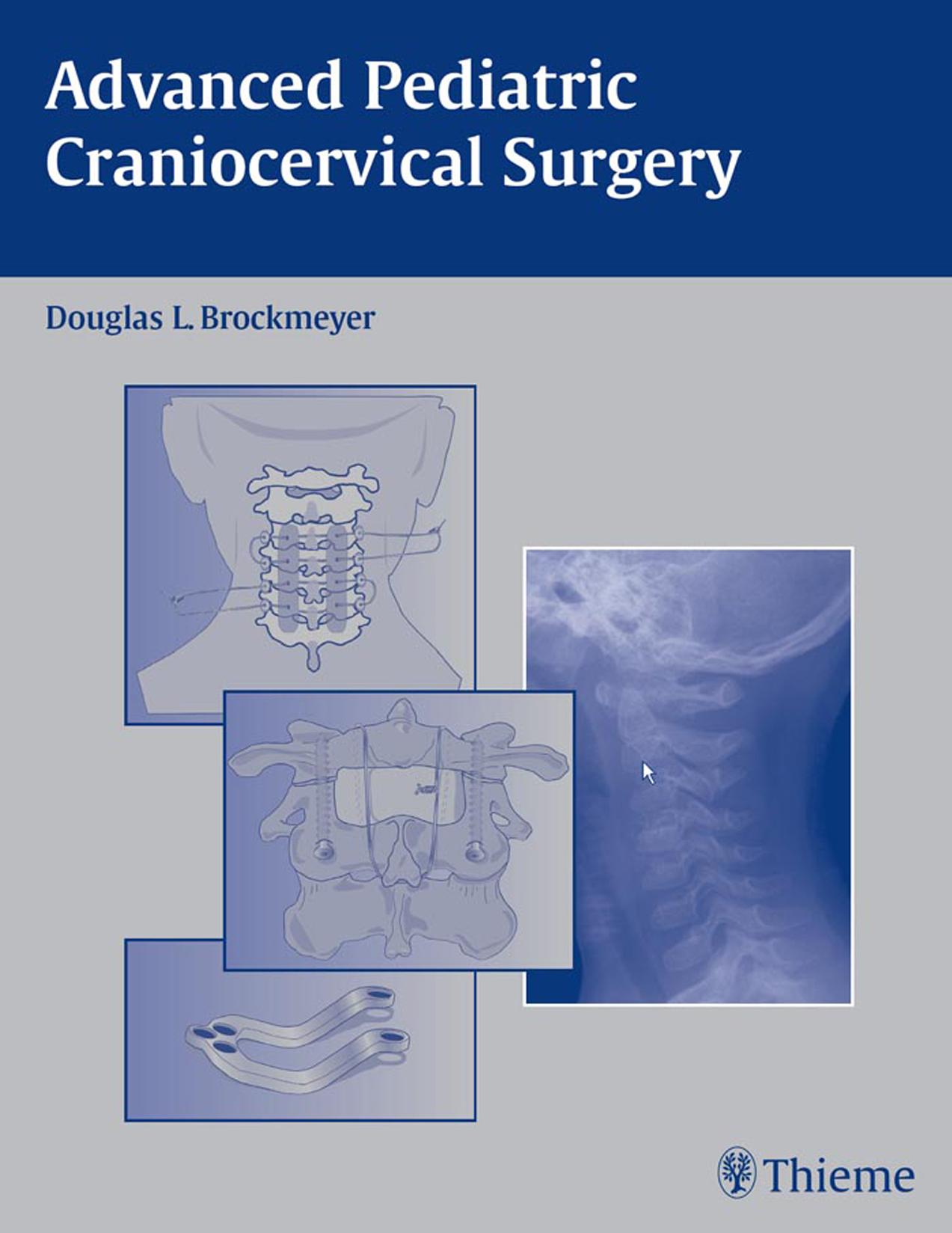 Advanced Pediatric Craniocervical Surgery by Brockmeyer Douglas