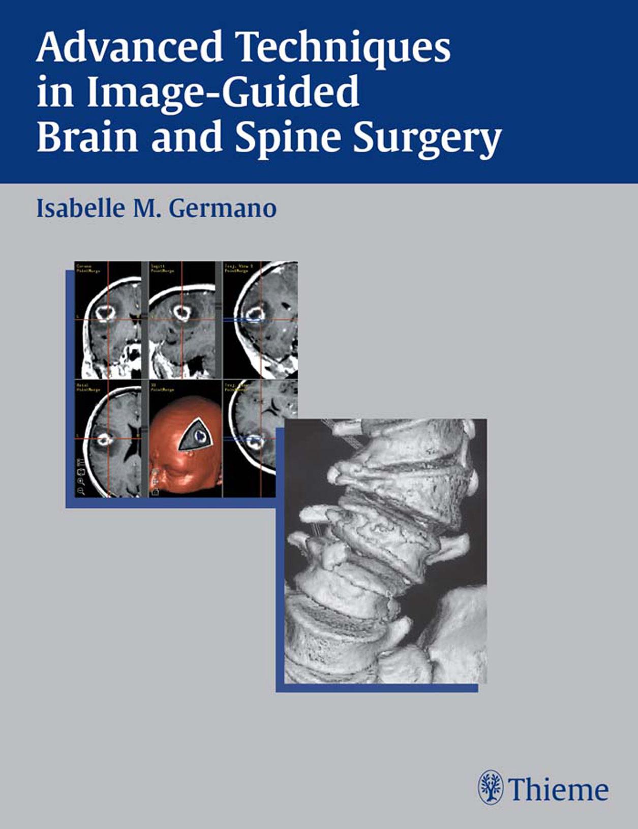 Advanced Techniques in Image-Guided Brain and Spine Surgery by Isabelle Germano