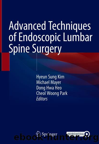 Advanced Techniques of Endoscopic Lumbar Spine Surgery by Unknown