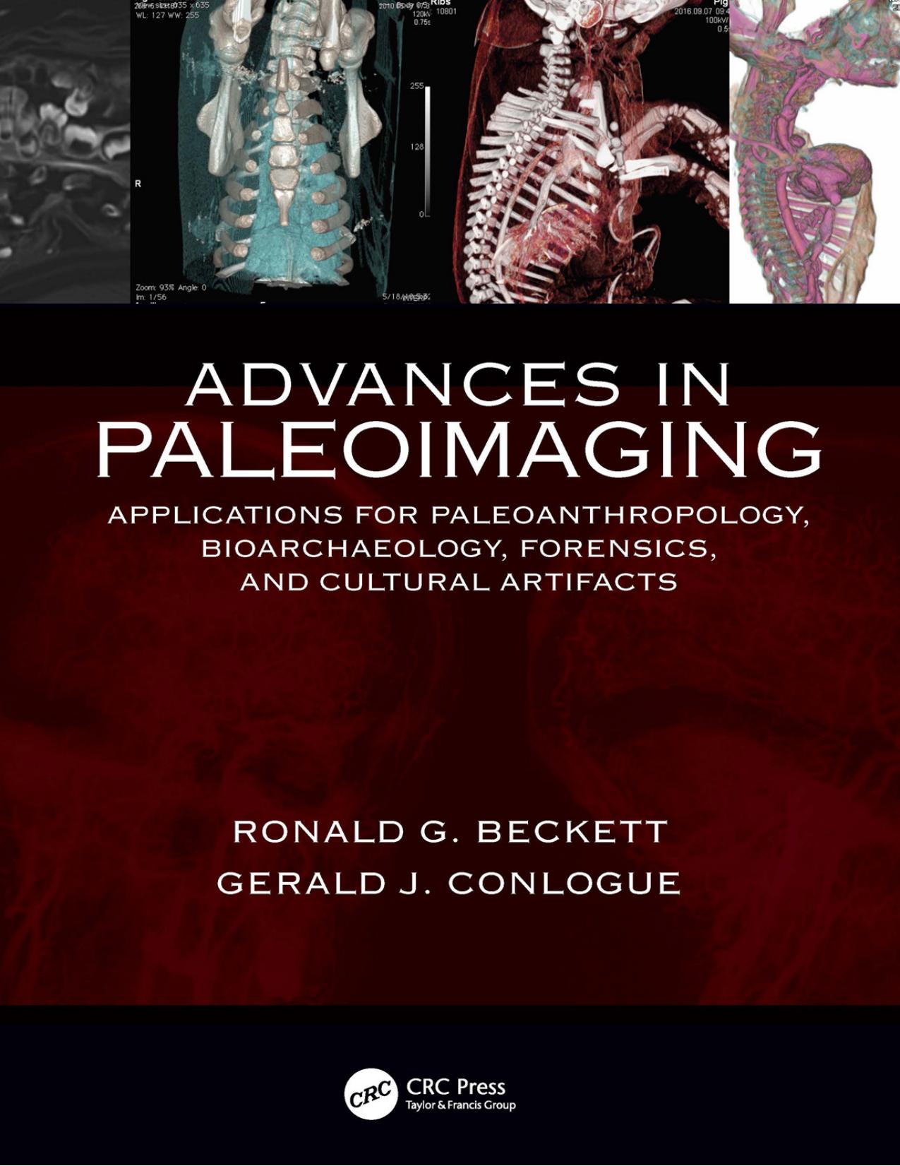 Advances in Paleoimaging; Applications for Paleoanthropology, Bioarchaeology, Forensics, and Cultural Artifacts by Ronald G. Beckett and Gerald J. Conlogue