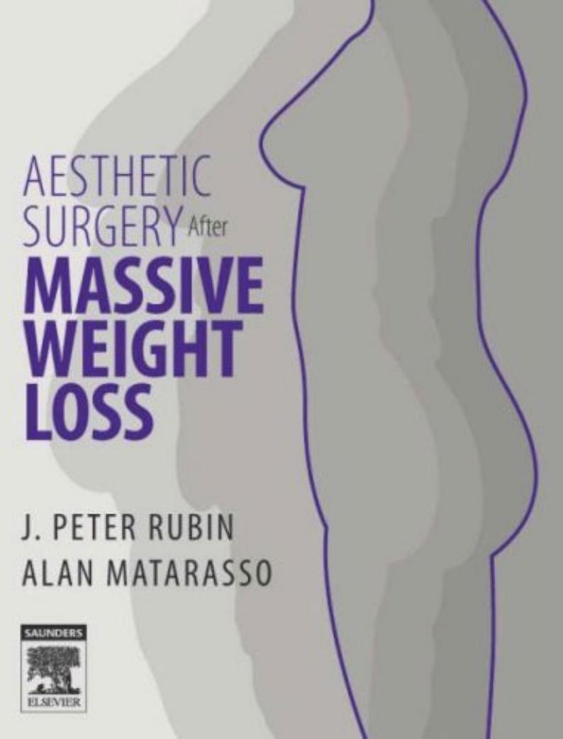 Aesthetic Surgery After Massive Weight Loss by J. Peter Rubin MD FACS Alan Matarasso MD