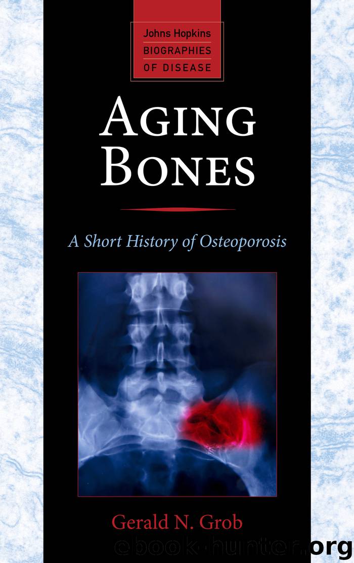 Aging Bones by Gerald N. Grob